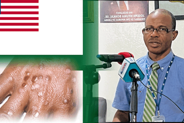 Monkeypox-Enters-Sinoe-One-Confirmed-Case-Reported