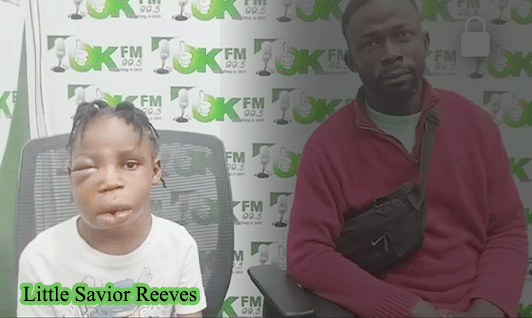 Six-Year-Old-Girl-Battles-Rare-Defect-Father-Cries-For-Surgical-Aid-Lucky-M.-McGee